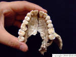 L_V20d5086 A16.31 R827 lR ta dentition on maxilla